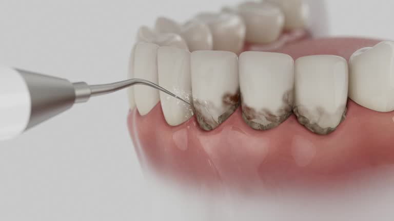 Reliable Dental contractor in Elyria, OH by Dentist Open Now